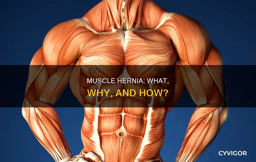 what is muscle hernia