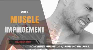 Understanding Muscle Impingement: Causes and Treatment Options