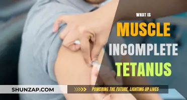 Understanding Muscle Incomplete Tetanus: Causes and Effects