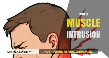 Muscle Intrusion: What It Is and How to Treat It