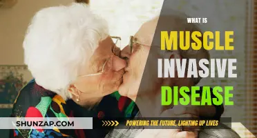 Understanding Muscle Invasive Disease