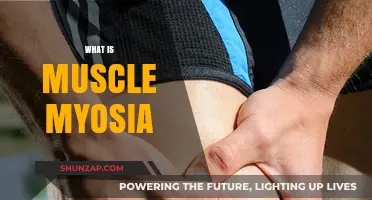 Understanding Muscle Myositis: Causes and Treatment