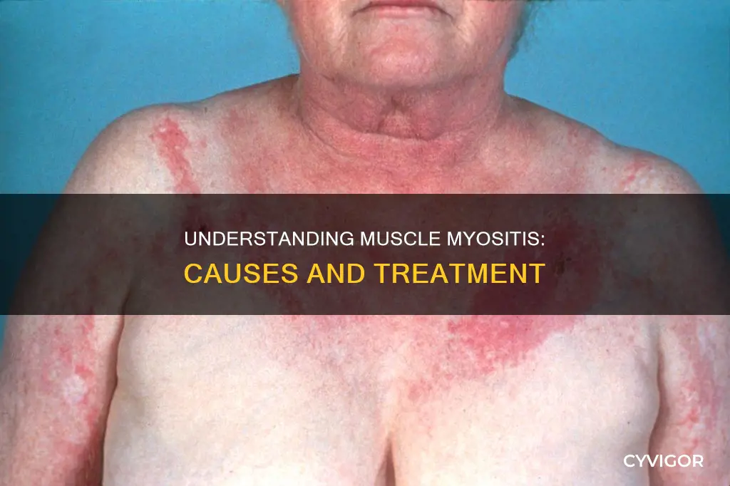 what is muscle myosia