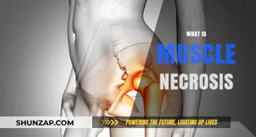 Understanding Muscle Necrosis: Causes and Effects
