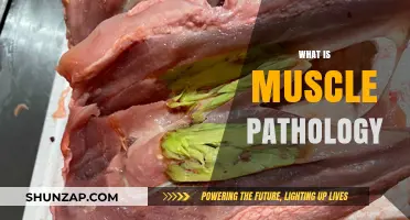 Understanding Muscle Pathology: What You Need to Know