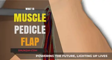 Muscle Pedicle Flap: Understanding This Surgical Technique