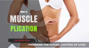 Understanding Muscle Plication Surgery and Its Benefits