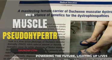 Muscle Pseudohypertrophy: Understanding the Misleading Muscle Growth