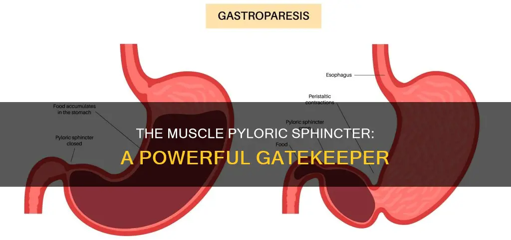 what is muscle pyloric sphincter