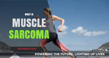 Understanding Muscle Sarcoma: A Rare Cancer Form