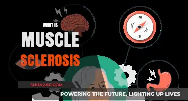 Understanding Muscle Sclerosis: Causes and Treatment