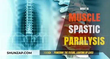 Understanding Muscle Spastic Paralysis: Causes and Effects