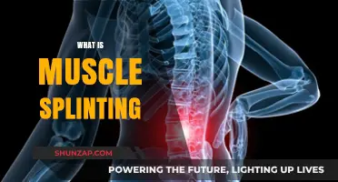 Understanding Muscle Splinting and Its Impact