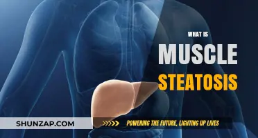 Muscle Steatosis: Understanding This Condition Affecting Your Muscles