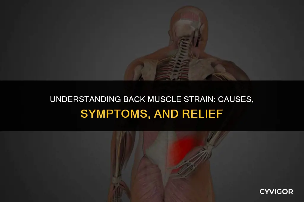 what is muscle strain in the back