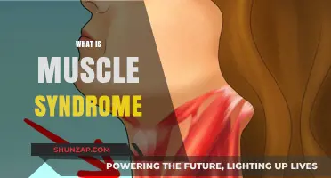 Muscle Syndrome: Understanding the Mystery Pain