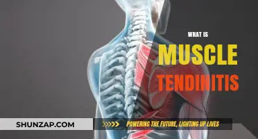 Muscle Tendinitis: Causes, Symptoms, and Treatment