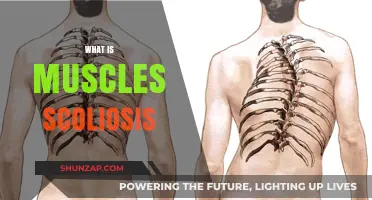 Muscular Scoliosis: What, Why, and How?