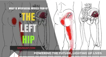 Understanding Myofascial Muscle Pain in the Left Hip: Causes and Relief