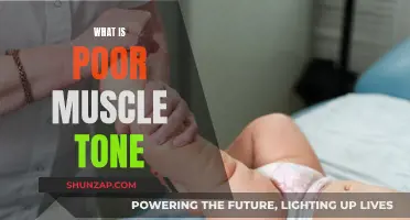Understanding Poor Muscle Tone: Causes and Effects