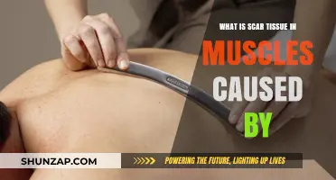 Understanding Muscle Scar Tissue: Causes, Formation, and Impact Explained