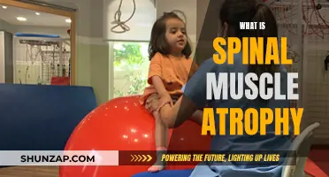 Understanding Spinal Muscular Atrophy: Causes and Symptoms