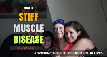 Understanding Stiff Muscle Disease: Causes and Treatments