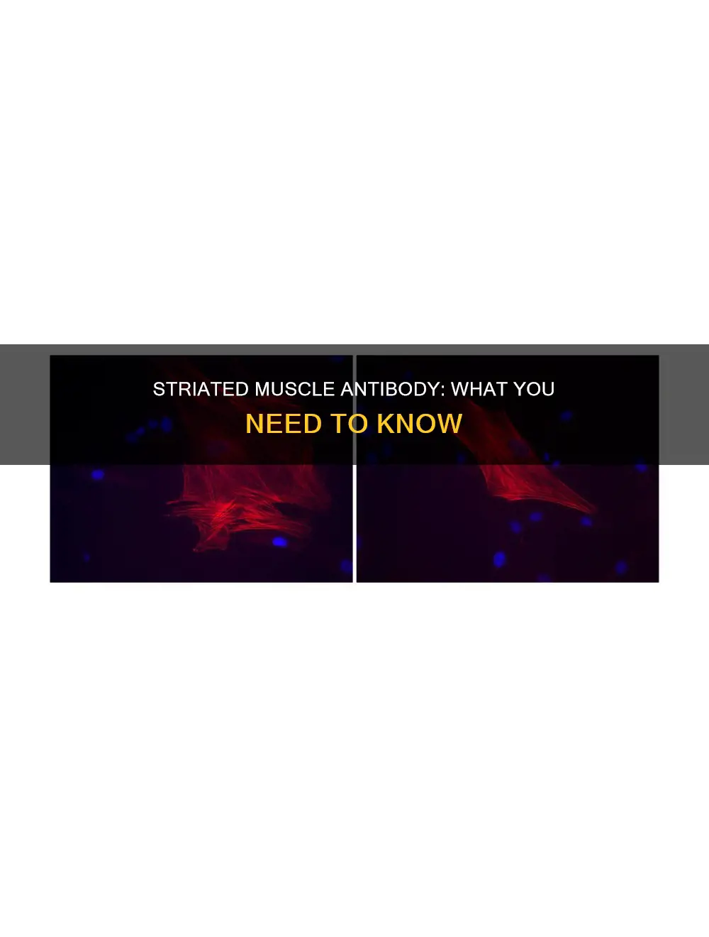 what is striated muscle antibody