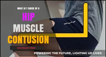 Understanding Hip Muscle Contusions: Causes, Symptoms, and Treatment Options