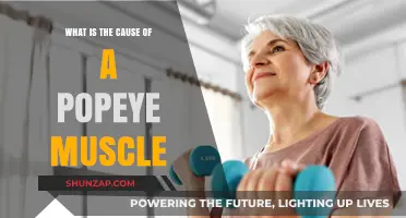 Understanding Popeye Muscle: Causes, Symptoms, and Treatment Options