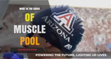 Understanding Muscle Pool: Causes, Symptoms, and Effective Treatment Options