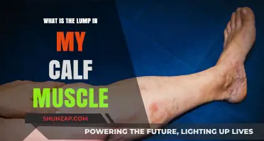Understanding Calf Muscle Lumps: Causes and When to Seek Help