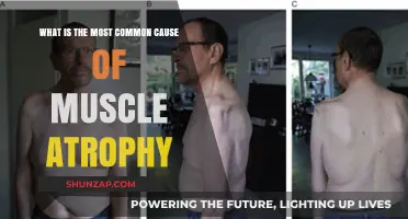 Understanding Muscle Atrophy: Uncovering the Leading Cause of Muscle Loss