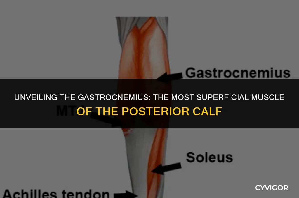 what is the most superficial muscle of the posterior calf