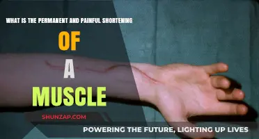 Understanding the Permanent and Painful Shortening of Muscles: Causes and Impact