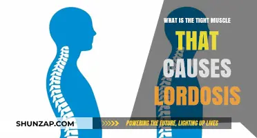 Understanding Lordosis: The Role of Tight Muscles in Spinal Curvature