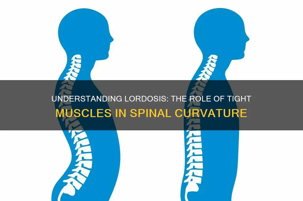 what is the tight muscle that causes lordosis