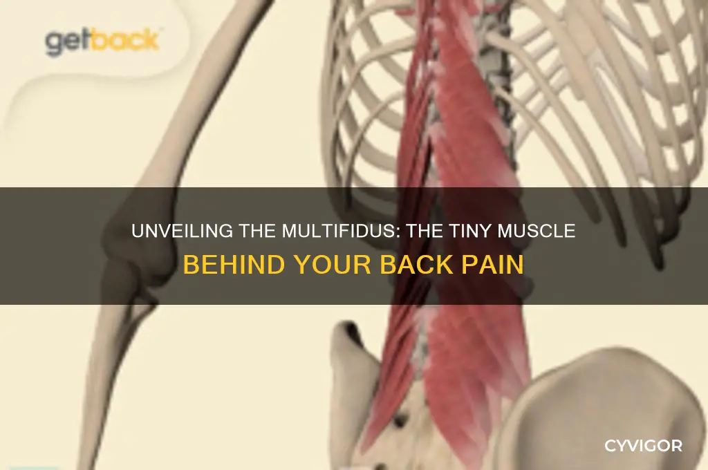 what is the tiny muscle that causes back pain