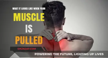 Pulled Muscle Symptoms: Recognizing Pain, Swelling, and Limited Mobility