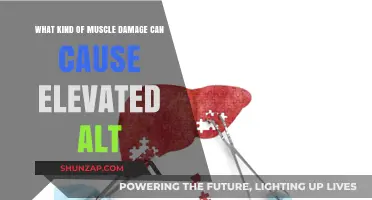 Muscle Damage and Elevated ALT: Understanding the Connection