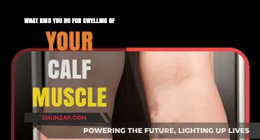 Relieving Calf Muscle Swelling: Effective Remedies and Prevention Tips