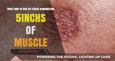 Bug Bites Causing Numbness: Identifying Culprits and Symptoms Explained