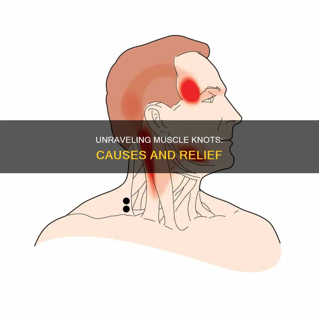 what knots in muscles