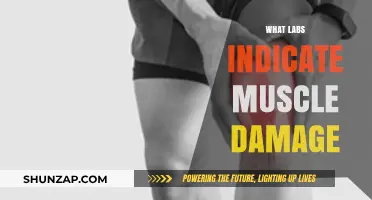 Indicators of Muscle Damage: Lab Tests and Results