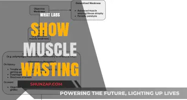 Muscle Wasting: What Do Lab Results Indicate?
