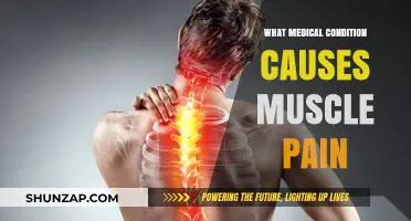 Understanding Muscle Pain: Medical Conditions That Could Be the Cause