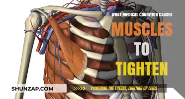 Understanding Muscle Tightness: Medical Conditions That Cause Stiff Muscles
