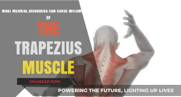 Medical Disorders Linked to Trapezius Muscle Inflammation: Causes Explained