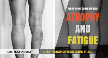 Understanding Muscle Atrophy and Fatigue: Causes and Contributing Factors