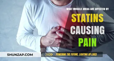 Statin-Induced Muscle Pain: Affected Areas and Potential Causes